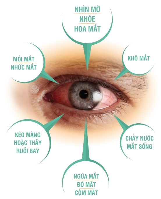 75% ca mù lòa do không kiểm soát tốt bệnh mắt