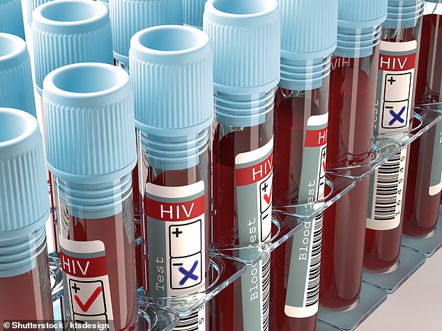 Phát hiện phương pháp làm cho AIDS "hết truyền nhiễm"