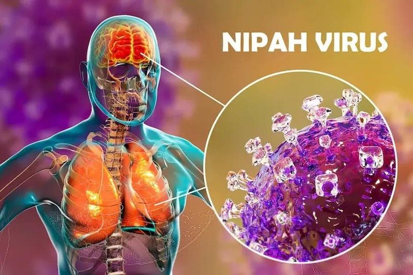 Virus Nipah có thể gây viêm hô hấp, viêm não dẫn đến tử vong. Ảnh: Getty