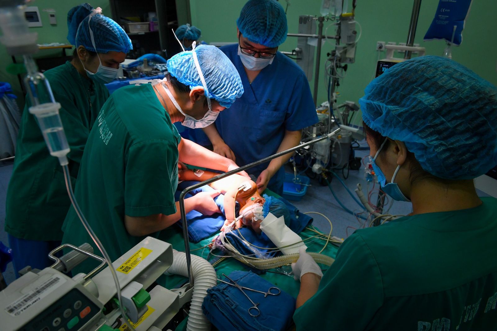 Hồi sinh trái tim “lỗi nhịp” của trẻ bằng kỹ thuật mới trong phẫu thuật