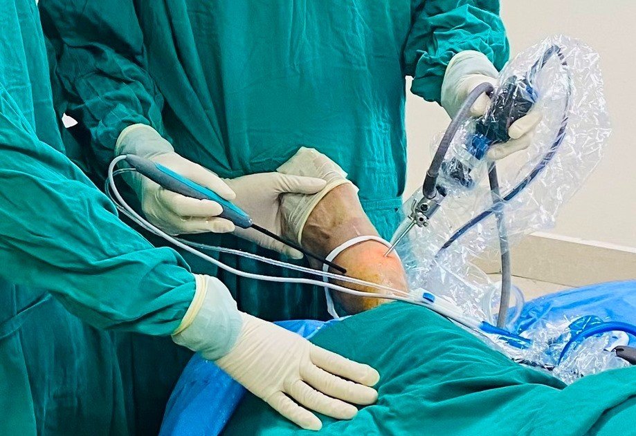 Lần đầu tiên triển khai kỹ thuật phẫu thuật nội soi khớp cổ chân ở Hà Tĩnh