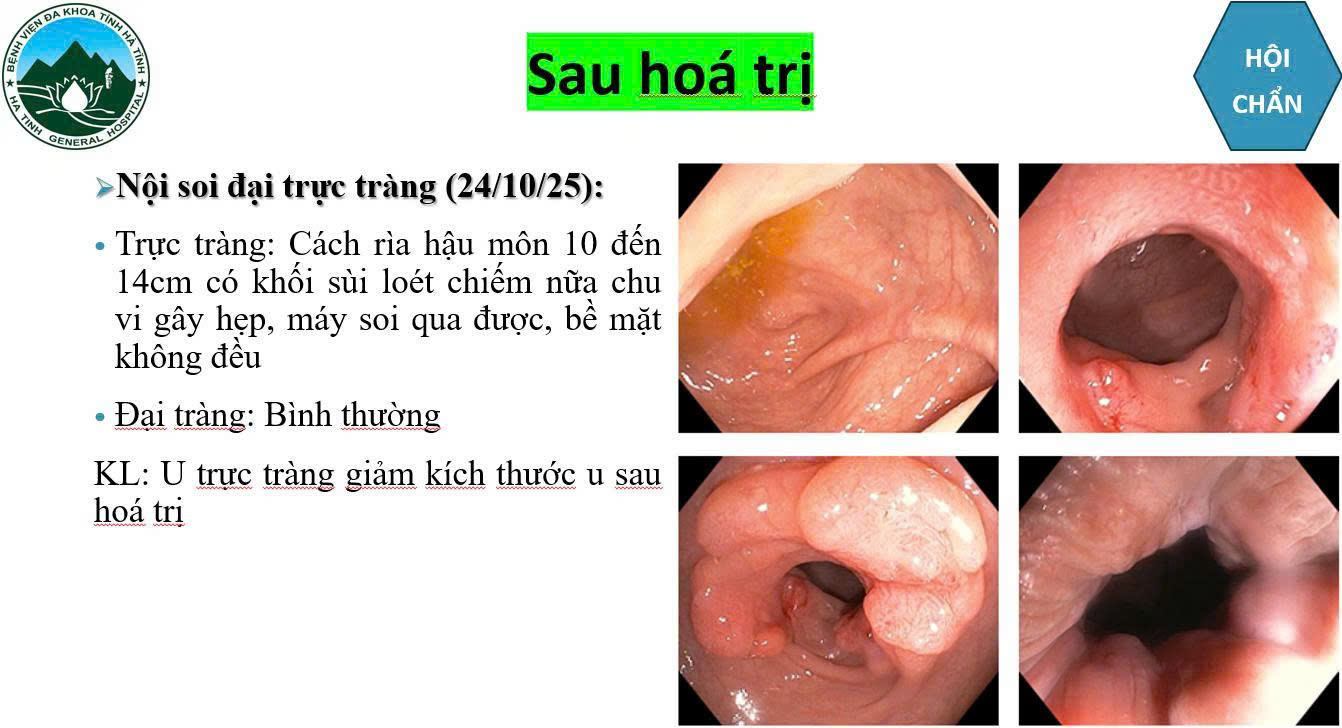 bqbht_br_1-1.jpg